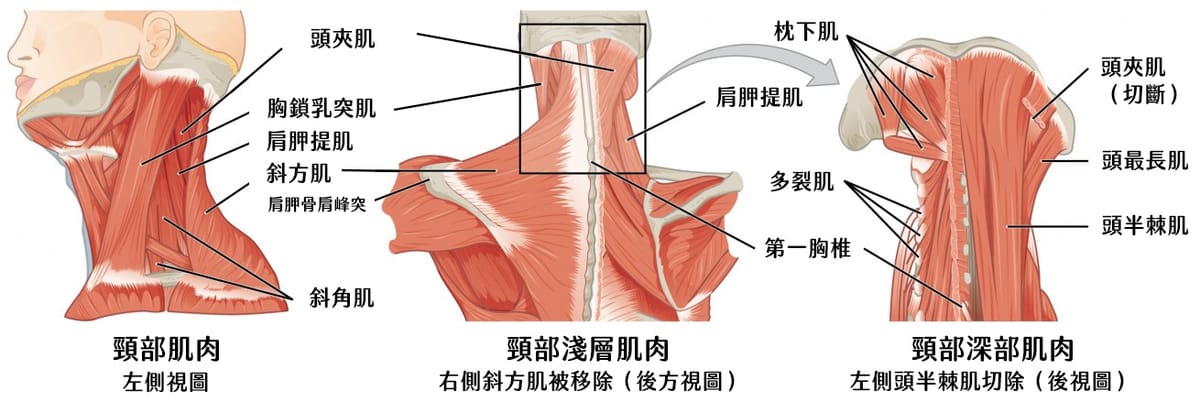 你的颈痛,可能是一场三个肌肉嫌疑犯策划的“完美犯罪”